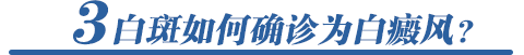 白斑如何确诊为白癜风?